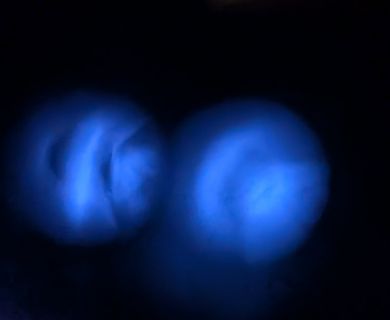 Zwei unscharfe blaue Lichtquellen