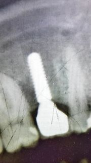 Abfotografierter medizinischer Röntgenbildschirm