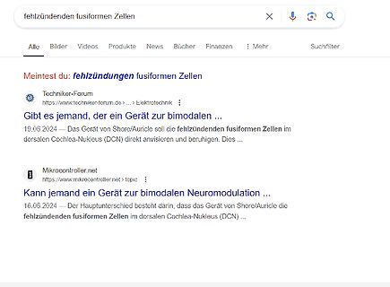 Google-Suchergebnisse zu fehlzündenden fusiformen Zellen