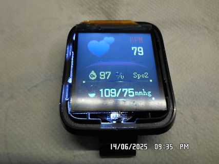 Abfotografiertes Display einer Smartwatch mit Vitalwerten